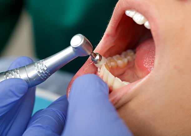 Oral Surgery in Irvine, KY